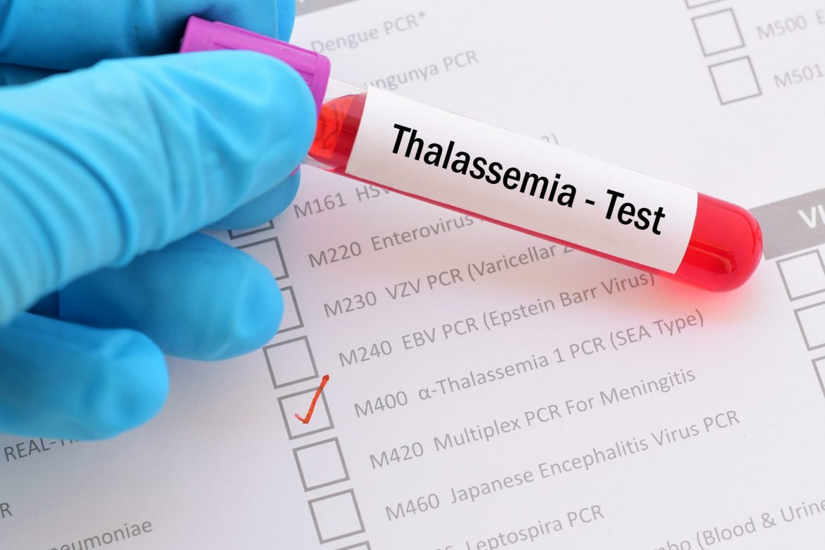 Everything you need to know about Thalassemia