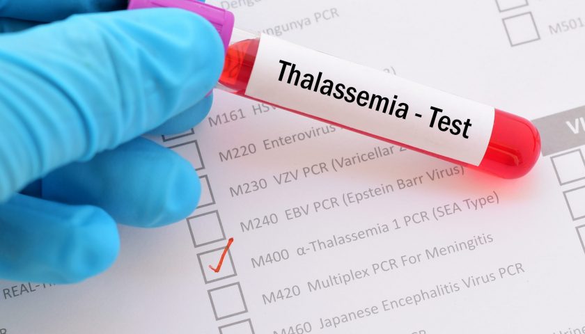 Everything you need to know about Thalassemia