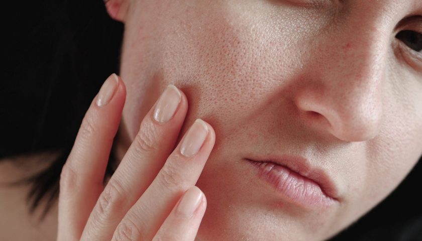 10 Different Ways you can minimize your Skin Pores