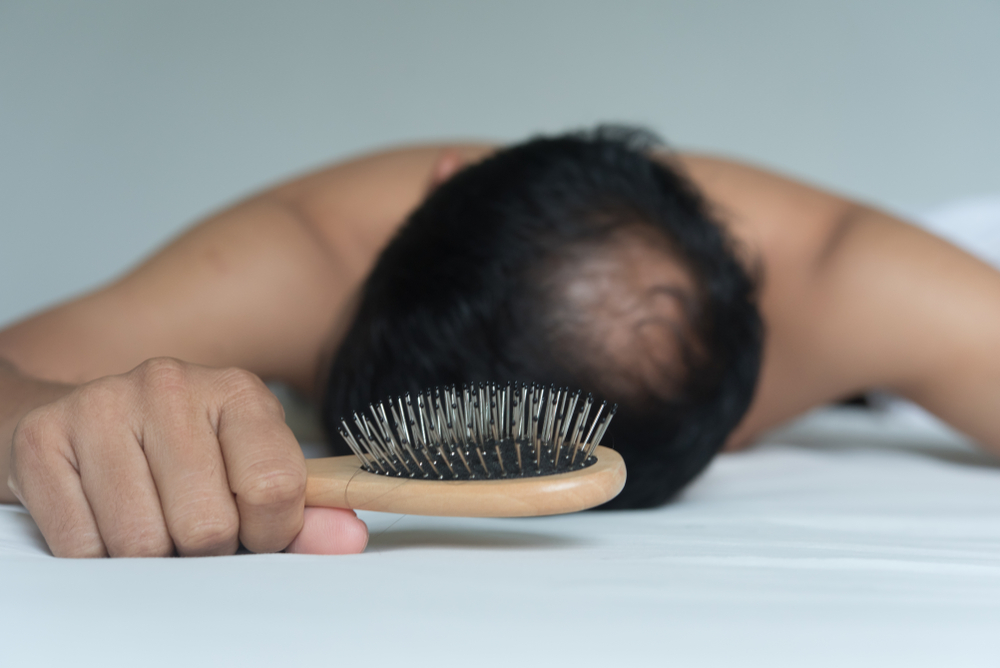Hey Men! These 13 Hair Fall Solutions Are for You - Healthwire