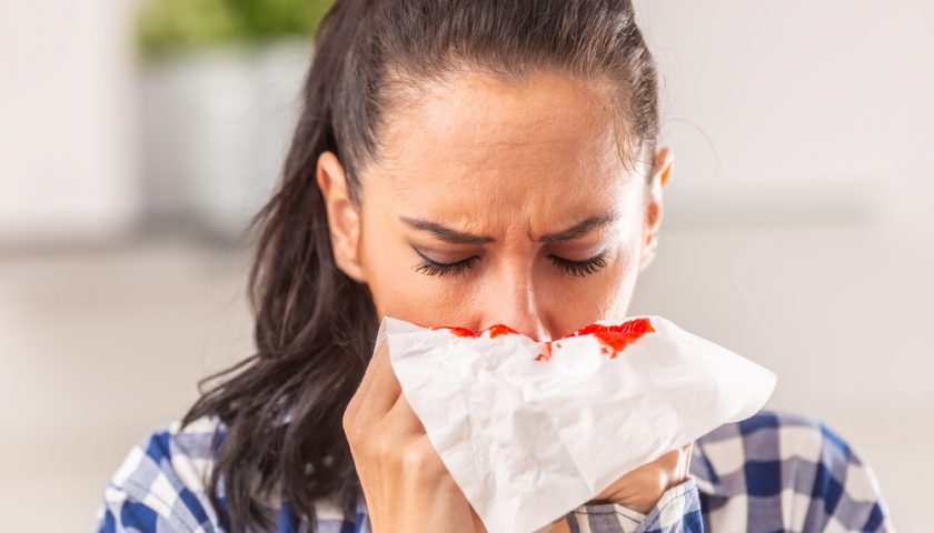 How to Stop Nose Bleeding