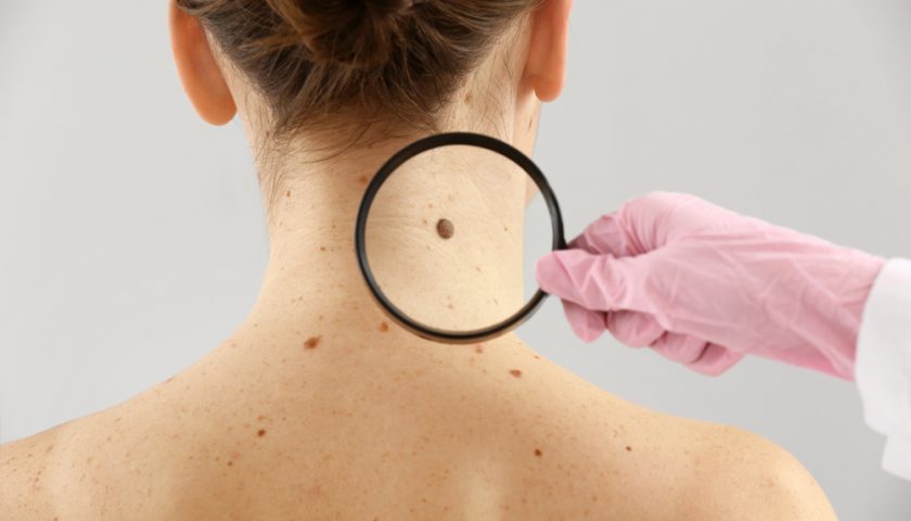 Effective Tips to Reduce the Risk of Skin Cancer