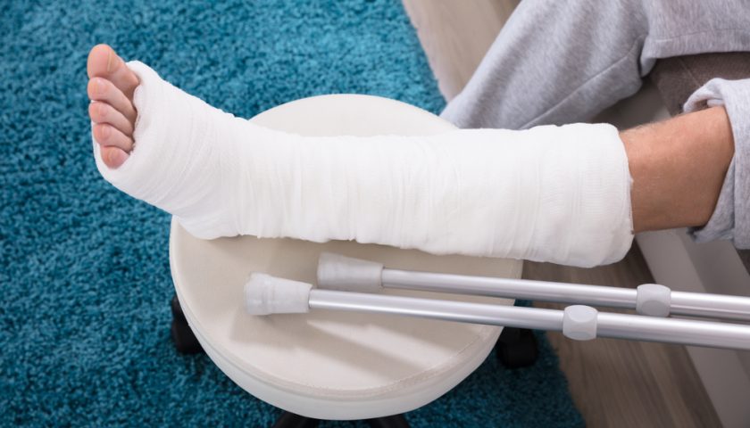 Foods to Heal Broken Bones Faster