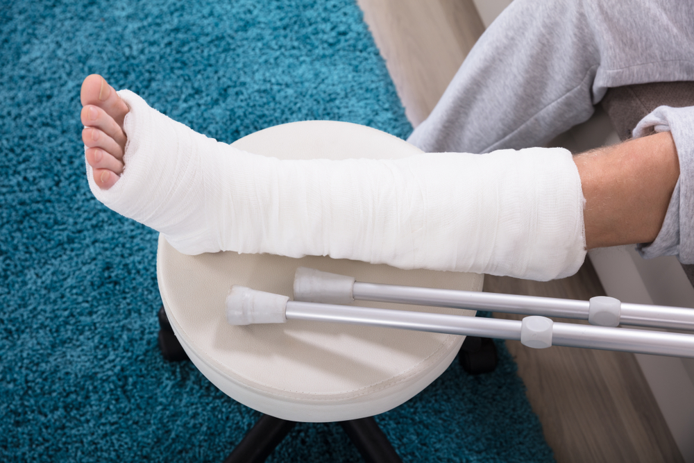 Foods To Heal Broken Bones Faster What To Eat During A Bone Fracture 