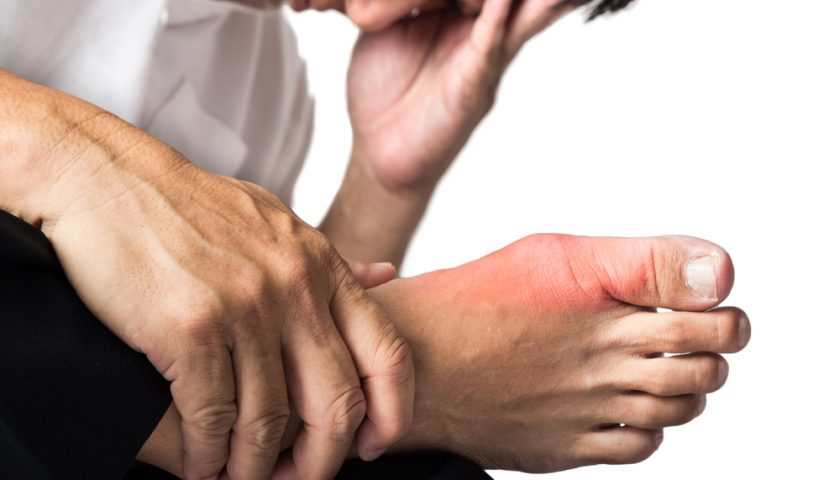 Uric Acid Treatments at Home