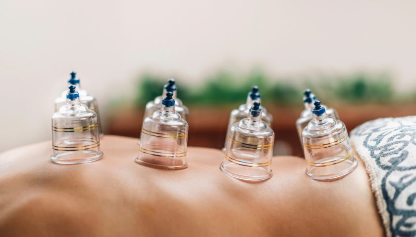 Hijama Kay Fayde
