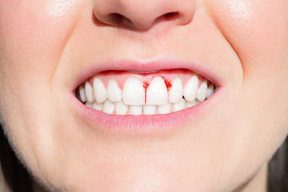 Is Gargling Salt Water Good For Your Teeth And Gums