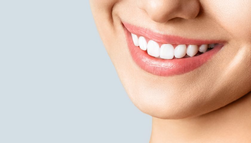How To Do Teeth Whitening