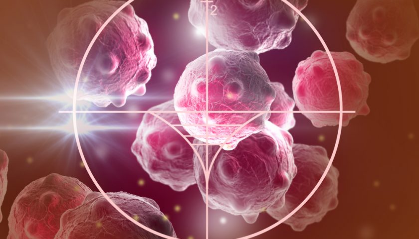stages-of-cancer