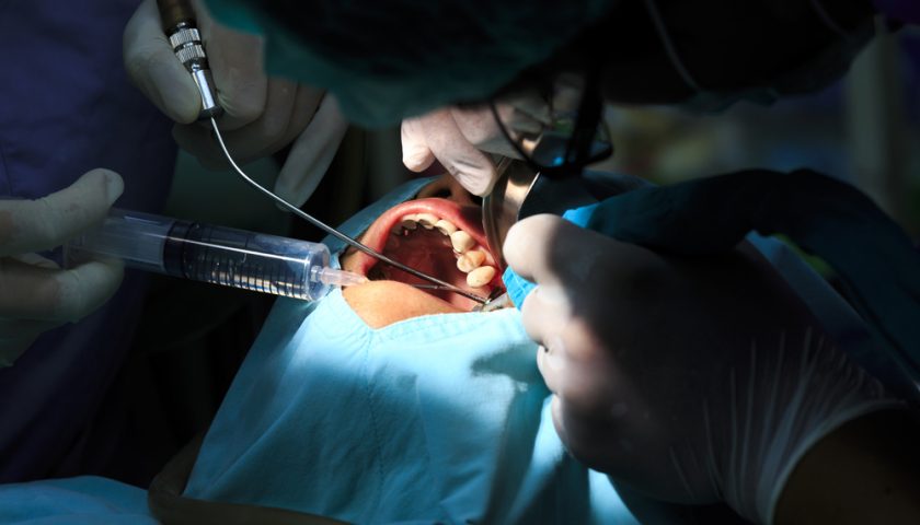 What To Eat After Oral Surgery