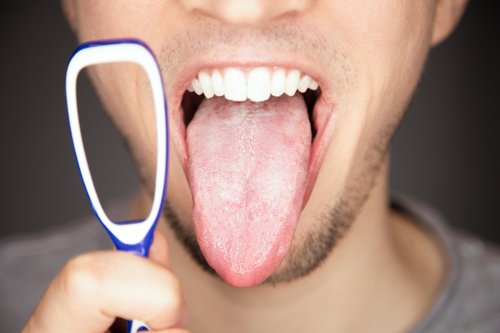 dehydration symptoms tongue