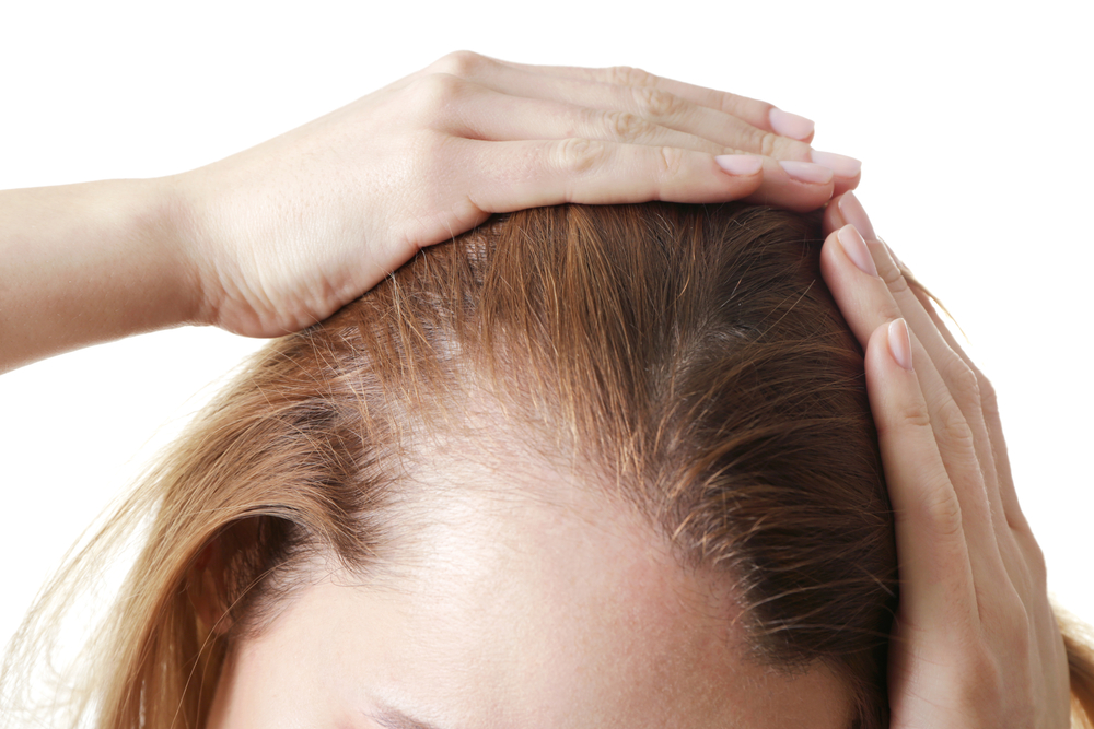 Regrow Your Hair Naturally - Tips for Alopecia Treatment - Healthwire