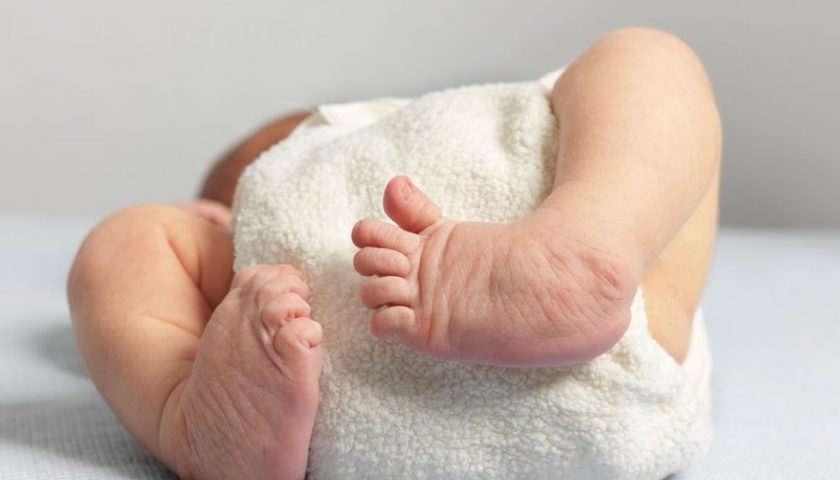 clubfoot-treatment-and-its-causes