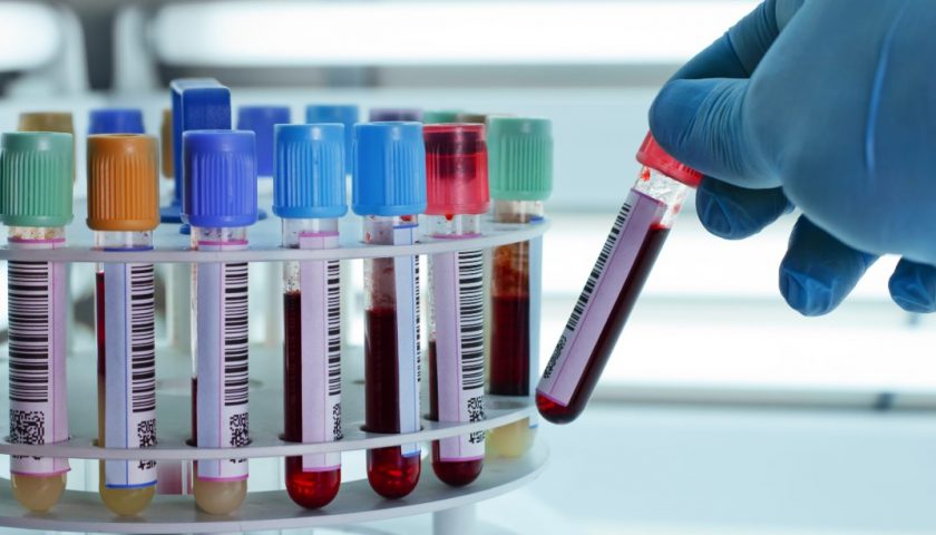 Essential Medical Tests For Men