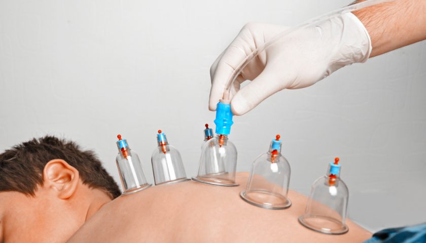 Hijama Benefits for Your Health