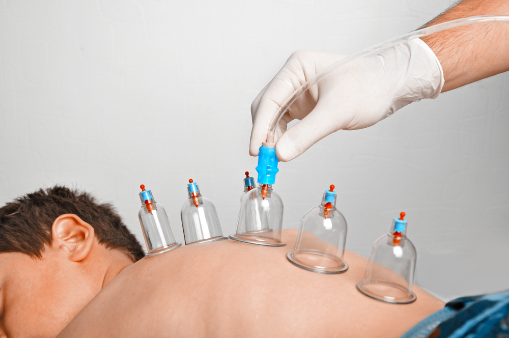 9 Powerful Hijama Benefits for Your Health - Healthwire