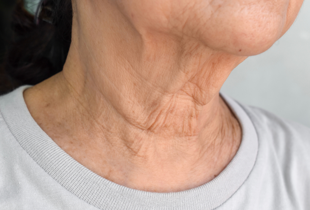 9 Tips And Home Remedies For Neck Wrinkles Say Bye To Neck Lines