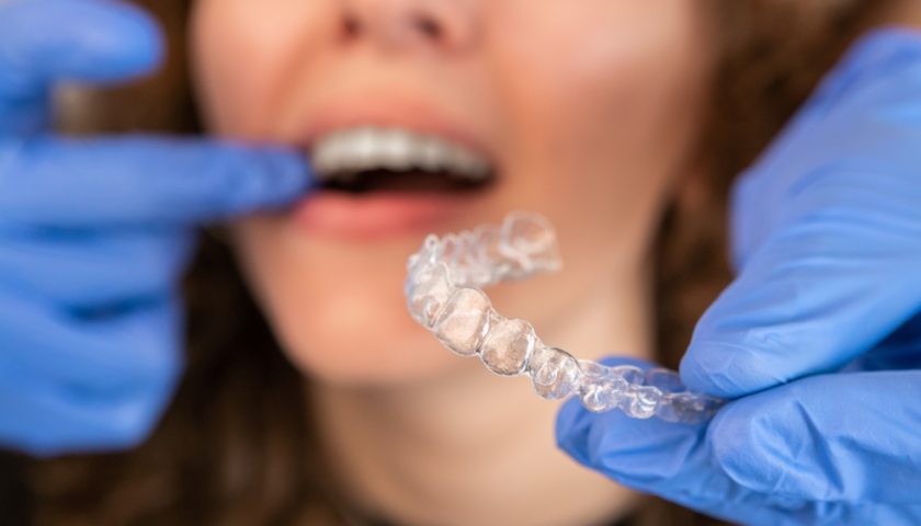 how-invisalign-work