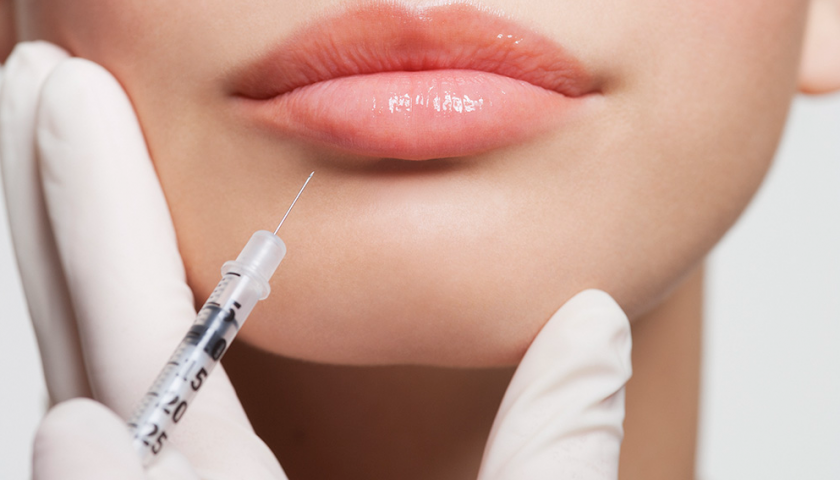 how-to-manage-side-effects-of-lip-fillers