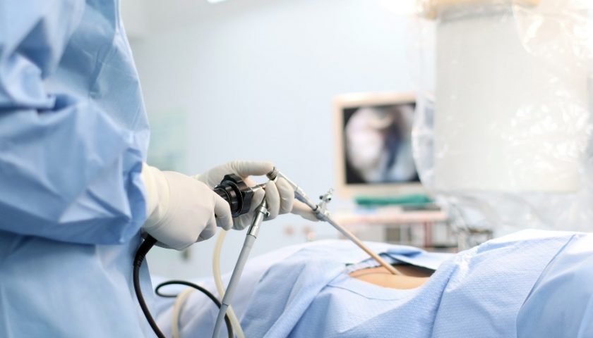 laparoscopic-surgery