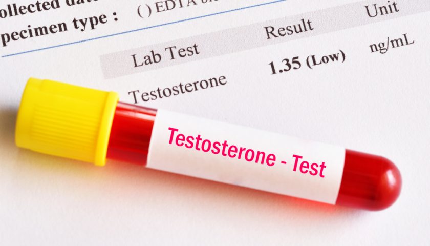 Low Testosterone Symptoms