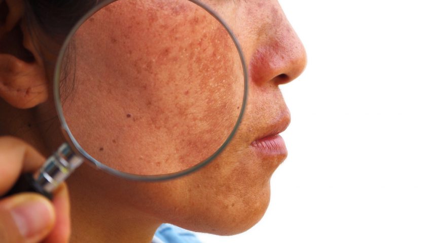 skin-changes-during-pregnancy