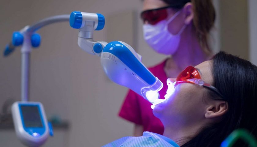 What is Laser Teeth Whitening