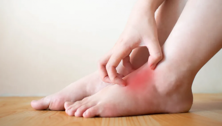 why-my-feet-burns