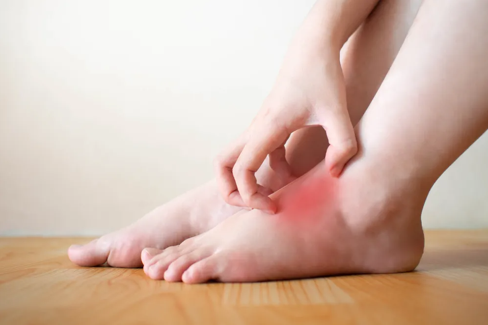 Why My Feet Burns A Complete Guidance One Click Ahead Healthwire