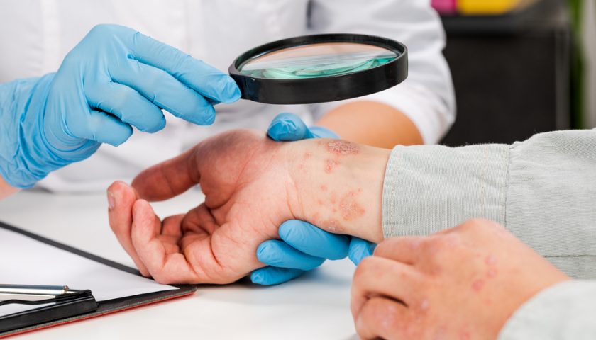 Skin Diseases You Must Treat Immediately