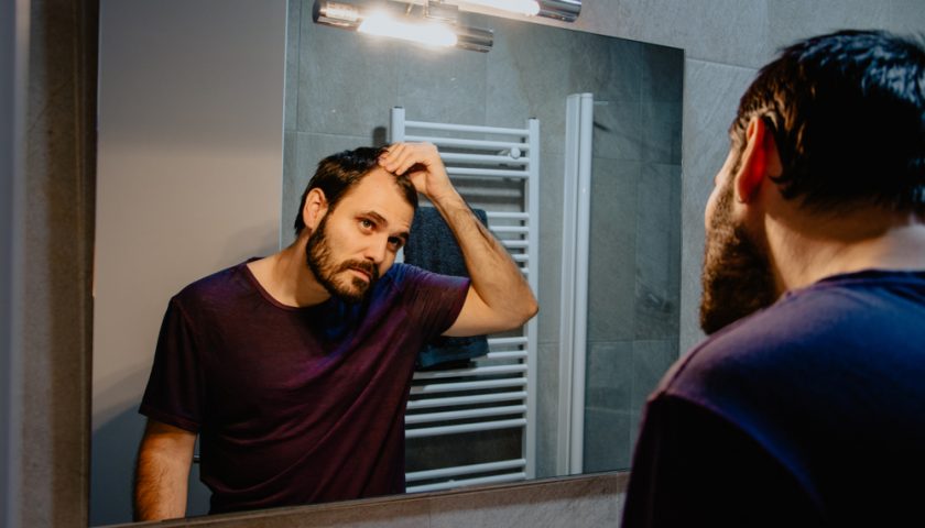 How to Stop a Receding Hairline in Men
