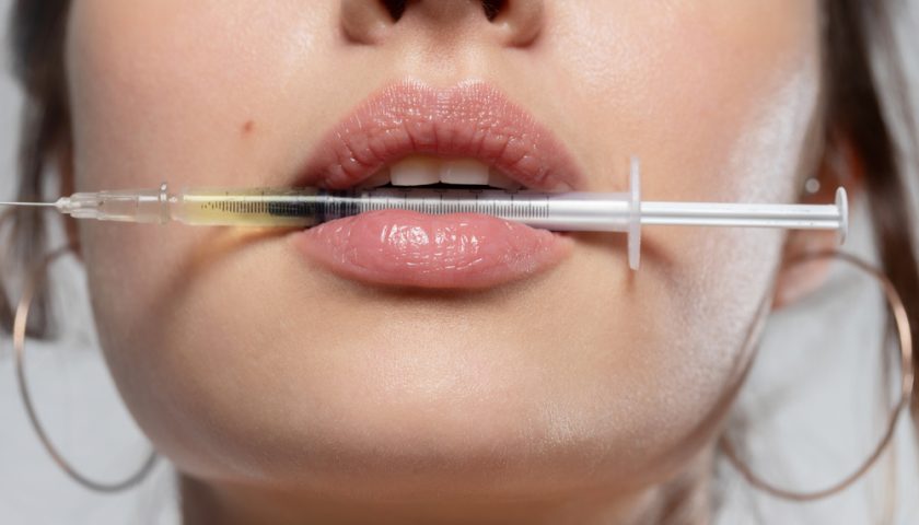 Lip Size Reduction Without Surgery
