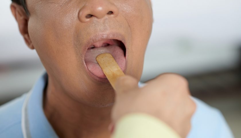 COVID Tongue Symptoms