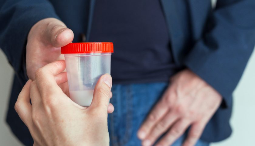 Semen Analysis Test