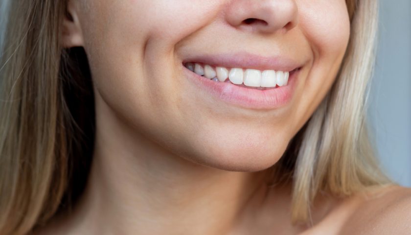 How to Get Dimples Permanently