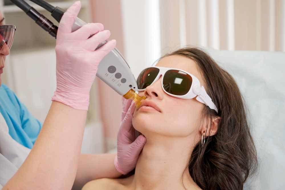 Q Switch Laser Procedure For A Flawless Skin Healthwire