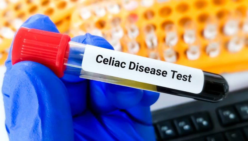 Celiac Disease Test
