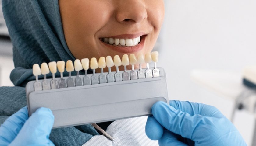 Veneers Vs Lumineers