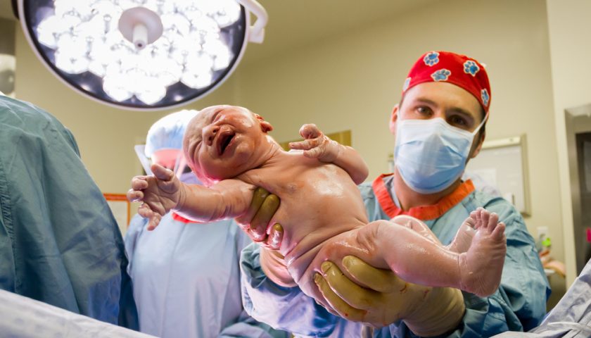 Types of Deliveries and Childbirth
