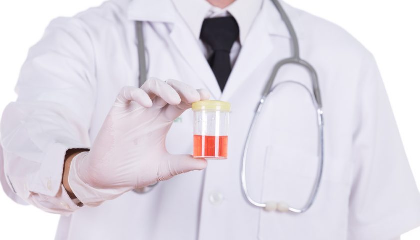 Blood in Urine