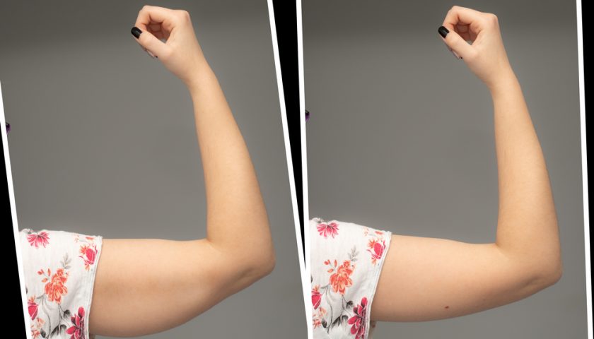 How to Lose Arm Fat