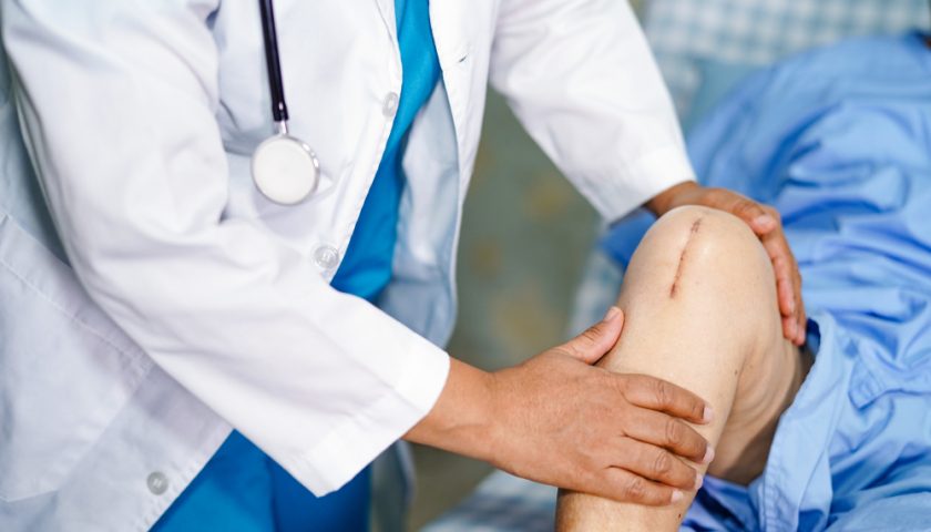 Knee Replacement Surgery