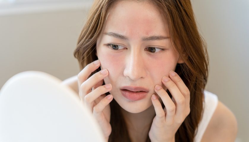 Skin Barrier