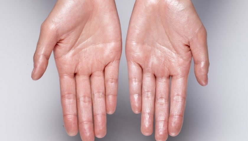 Sweaty Hands