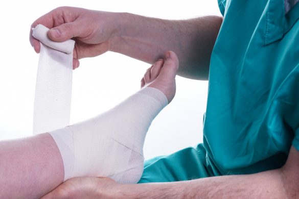Sprained Leave یورک ایسڈ کے 8 علاج ، اس کی وجوہات اور علامات - Health & Wellness Blog ...