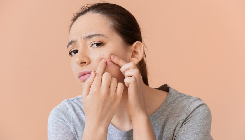 How Does Sugar Affect Your Skin