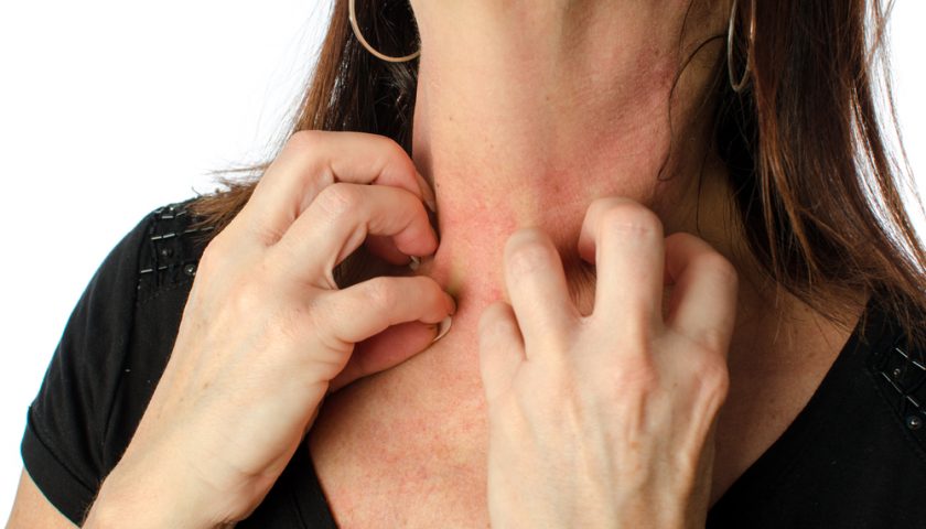 Summer Skin Problems And Solutions