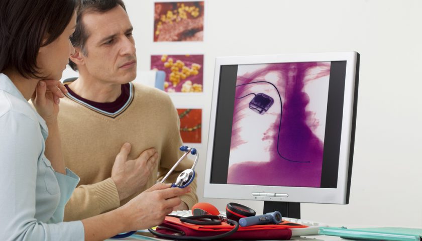Dos and Don’ts After Pacemaker Surgery