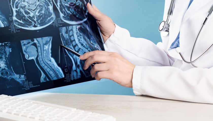 Spinal Cord Tumors