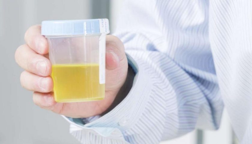 White Particles in Urine